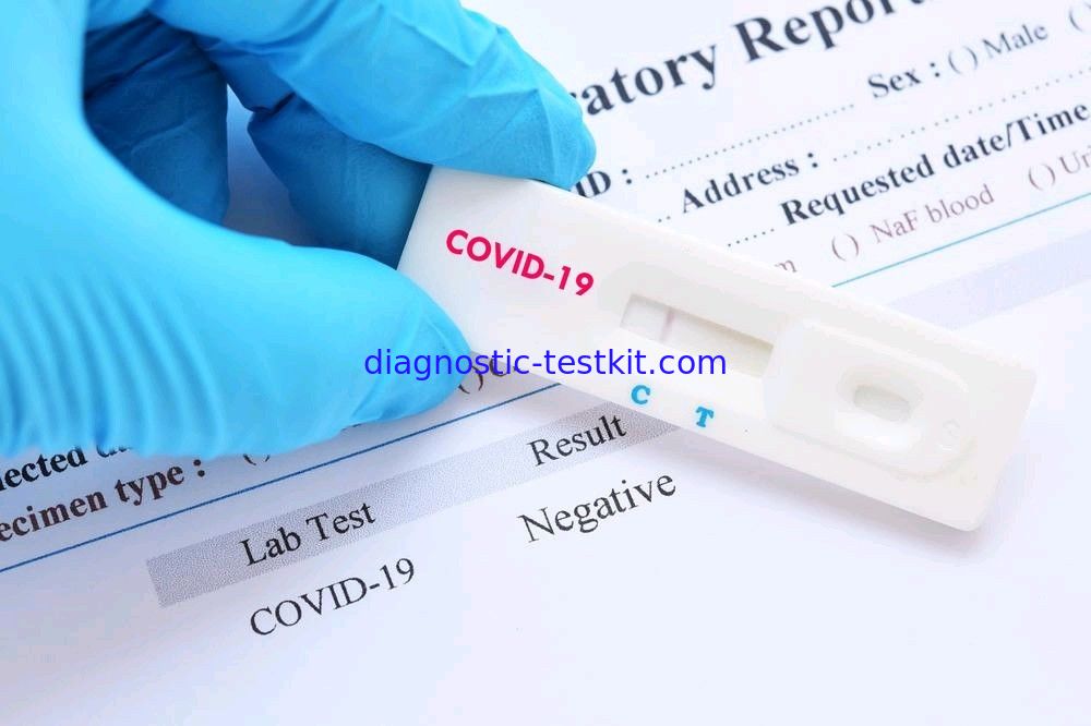 SARS-CoV-2 COVID 19 Antibody Lab Rapid Test IgM IgG Detection Kit